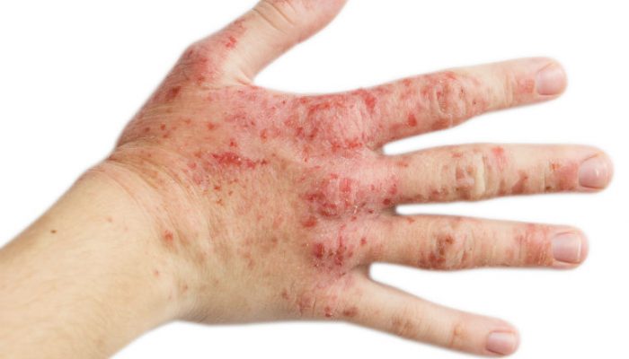 Four workshop contaminants to avoid direct skin contact with